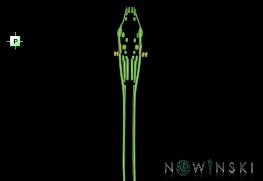 G1.T19.16.V3.C1.L0.Cranial nerve nuclei