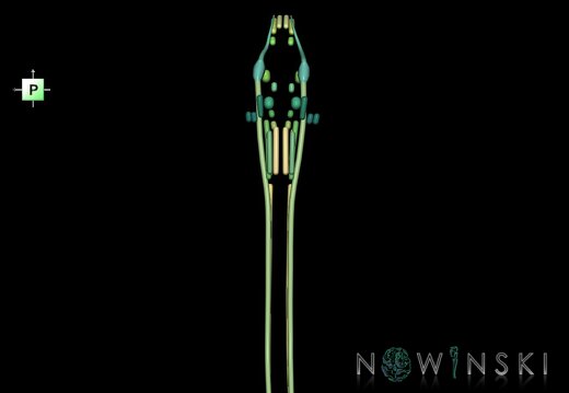 G1.T19.16.V3.C2.L0.Cranial nerve nuclei