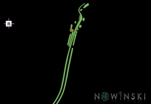 G1.T19.16.V4.C1.L0.Cranial nerve nuclei