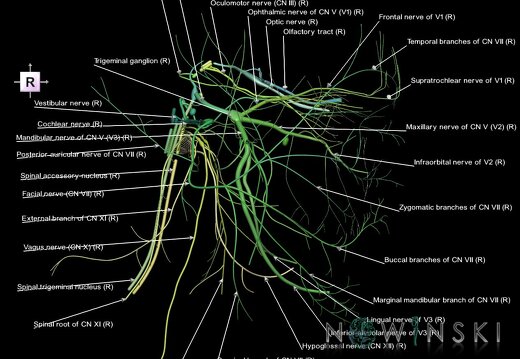 G1.T19.3.V4.C2.L1.Cranial nerves right