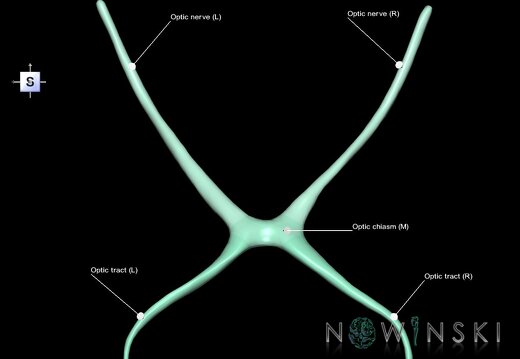 G1.T19.5.V5.C2.L1.Optic nerve