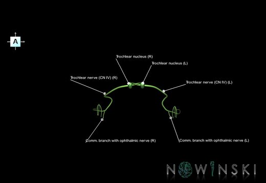 G1.T19.7.V1.C2.L1.Trochlear nerve