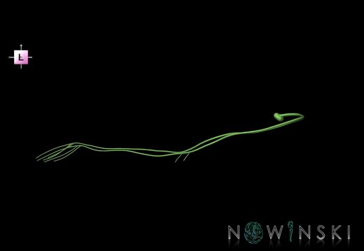 G1.T19.7.V2.C1.L0.Trochlear nerve