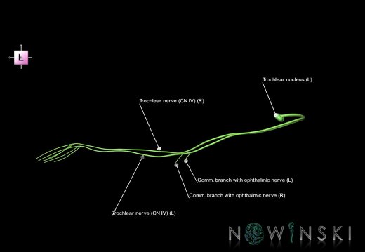 G1.T19.7.V2.C2.L1.Trochlear nerve