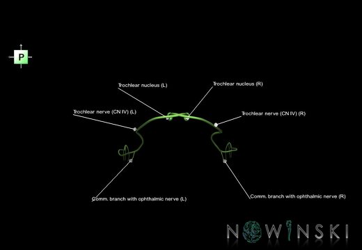 G1.T19.7.V3.C2.L1.Trochlear nerve