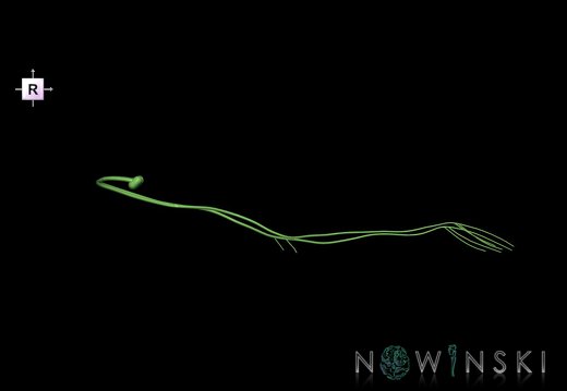 G1T19.7.TrochlearNerve