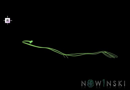 G1.T19.7.V4.C2.L0.Trochlear nerve
