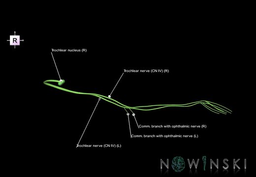 G1.T19.7.V4.C2.L1.Trochlear nerve