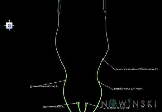 G1.T19.7.V5.C2.L1.Trochlear nerve
