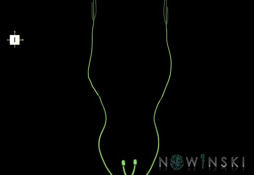 G1.T19.7.V6.C2.L0.Trochlear nerve