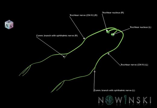 G1.T19.7.V7.C2.L1.Trochlear nerve