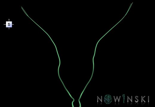 G1.T19.9.V5.C2.L0.Abducens nerve