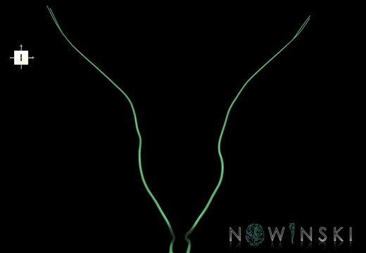 G1.T19.9.V6.C2.L0.Abducens nerve