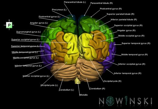 G1.T2.1.V3.C3.L1.Brain whole