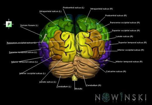 G1.T2.1.V3.C4.L1.Brain whole