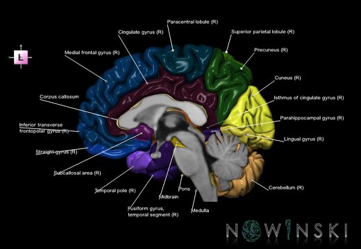 G1.T2.3.V2.C3.L1.Brain right