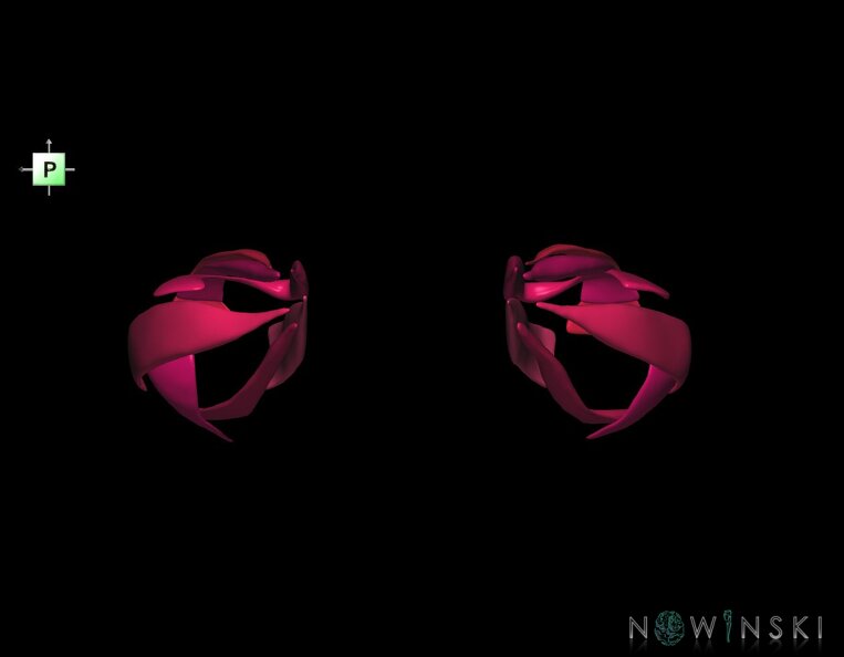 G1.T20.4.V3.C2.L0.Extraocular_muscles.tiff