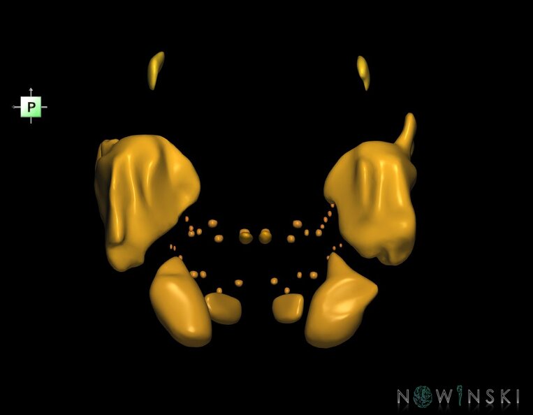 G1.T21.V3.C2.L0.Glands.tiff
