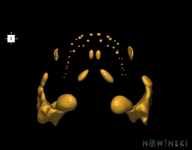 G1.T21.V6.C1.L0.Glands.tiff