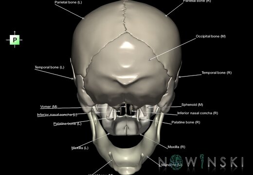 G1.T22.1.V3.C2.L1.Skull whole