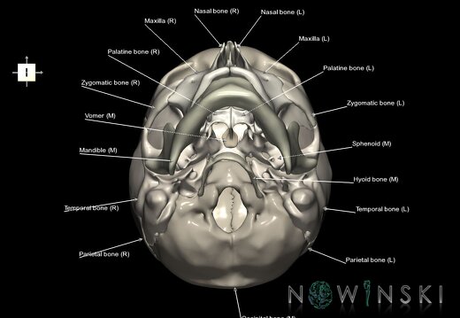 G1.T22.1.V6.C2.L1.Skull whole