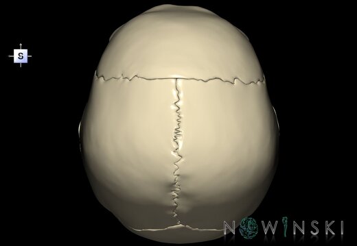 G1.T22.2.V5.C1.L0.Neurocranium