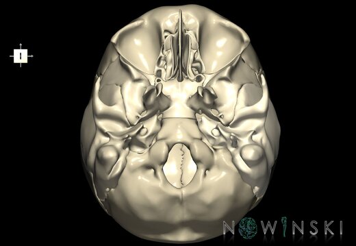 G1.T22.2.V6.C1.L0.Neurocranium