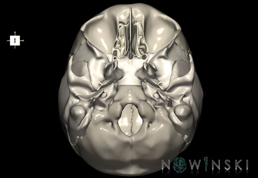 G1T22.2.Neurocranium