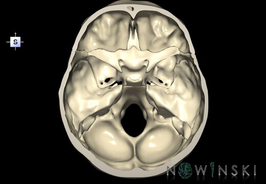 G1.T22.3.V5.C1.L0.Skull base