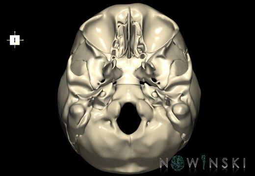 G1.T22.3.V6.C1.L0.Skull base