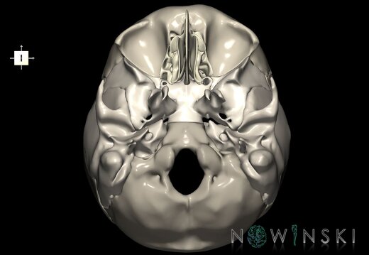 G1.T22.3.V6.C2.L0.Skull base
