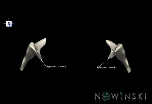G1T22.5.10.ZygomaticBone
