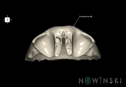 G1T22.5.3.FrontalBone