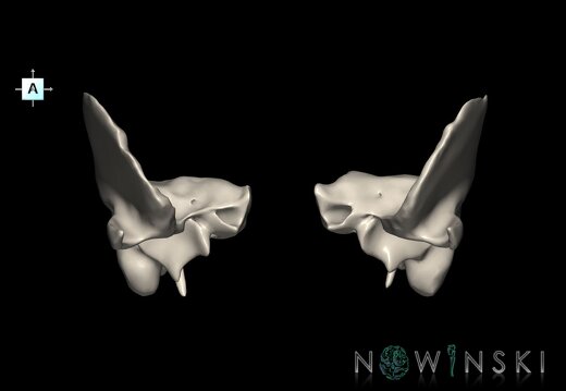 G1T22.5.9.TemporalBone