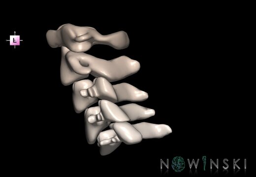 G1.T23.V2.C2.L0.Cervical spine