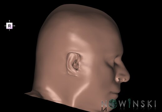 G1.T24.2.V4.C2.L0.Skin left