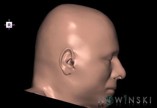 G1.T24.3.V4.C2.L0.Skin right