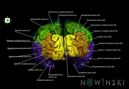 G1.T3.1.V3.C4.L1.Cerebrum whole