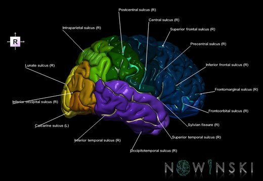 G1.T3.1.V4.C4.L1.Cerebrum whole