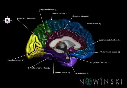 G1.T3.2.V4.C4.L1.Cerebrum left