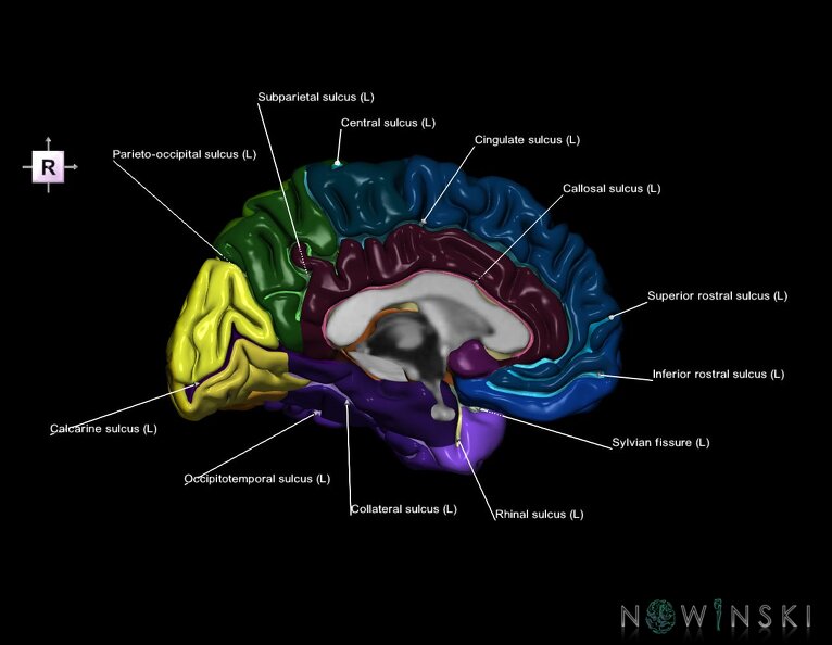 G1.T3.2.V4.C4.L1.Cerebrum_left.tiff