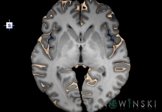 G1T4.5.InsularLobe