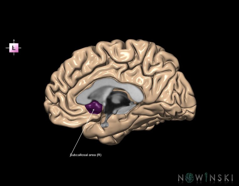 G1.T5.6.V2.C13.L1.Subcallosal_area_right.tiff