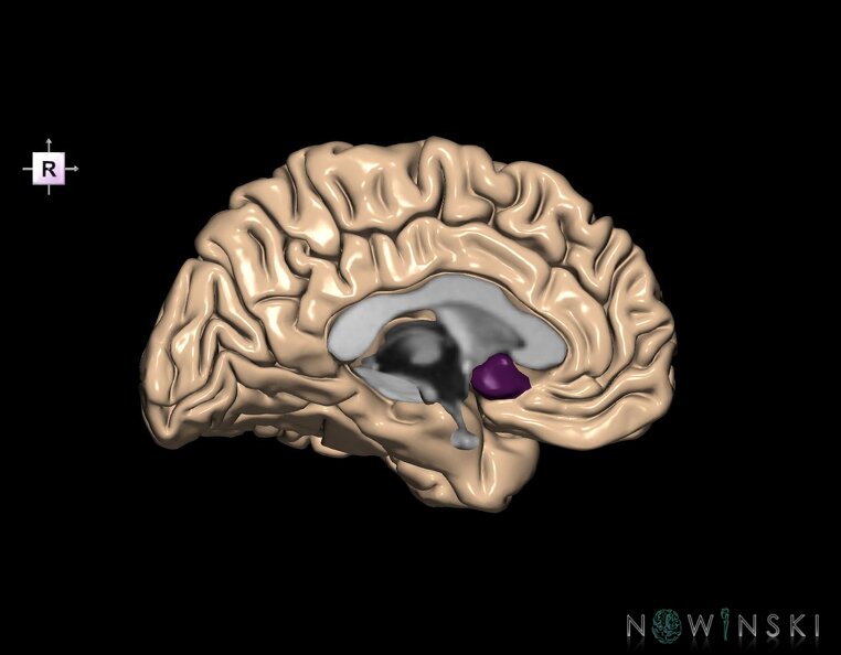 G1.T5.6.V4.C13.L0.Subcallosal_area_left.tiff