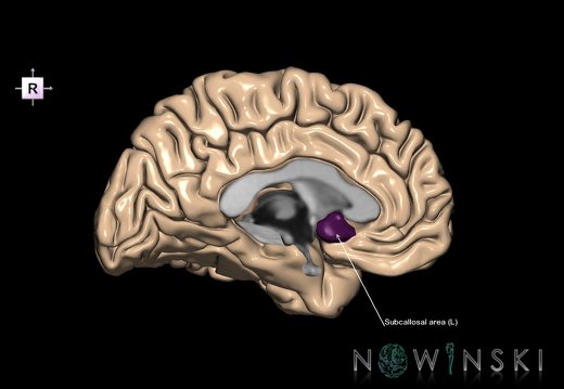 G1T5.6.SubcallosalPlane