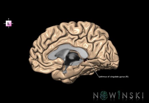 G1.T6.10.V2.C13.L1.Isthmus of cingulate gyrus right