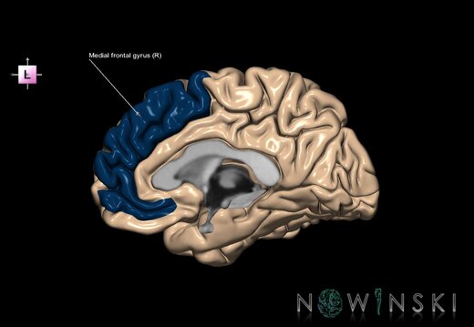 G1.T6.12.V2.C13.L1.Medial frontal gyrus right