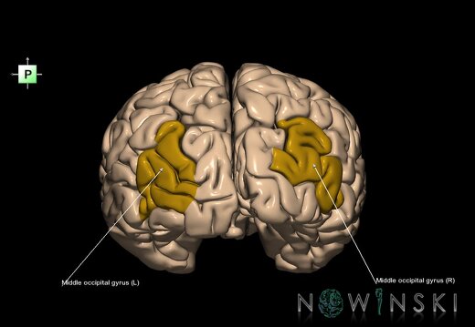 G1.T6.14.V3.C13.L1.Middle occipital gyrus