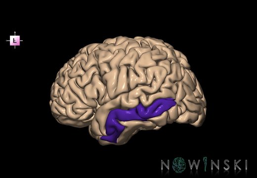 G1.T6.15.V2.C13.L0.Middle temporal gyrus left