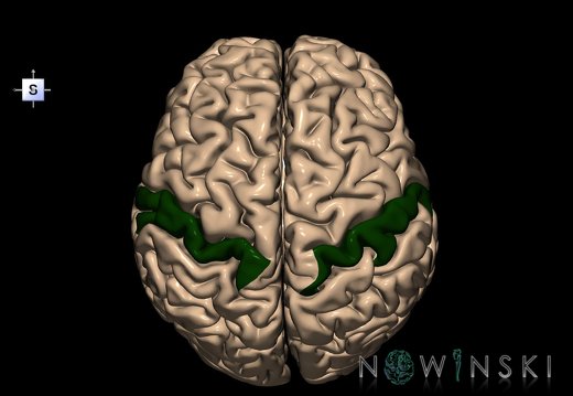 G1.T6.19.V5.C13.L0.Postcentral gyrus